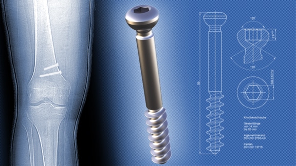 Bone screw for medical technology